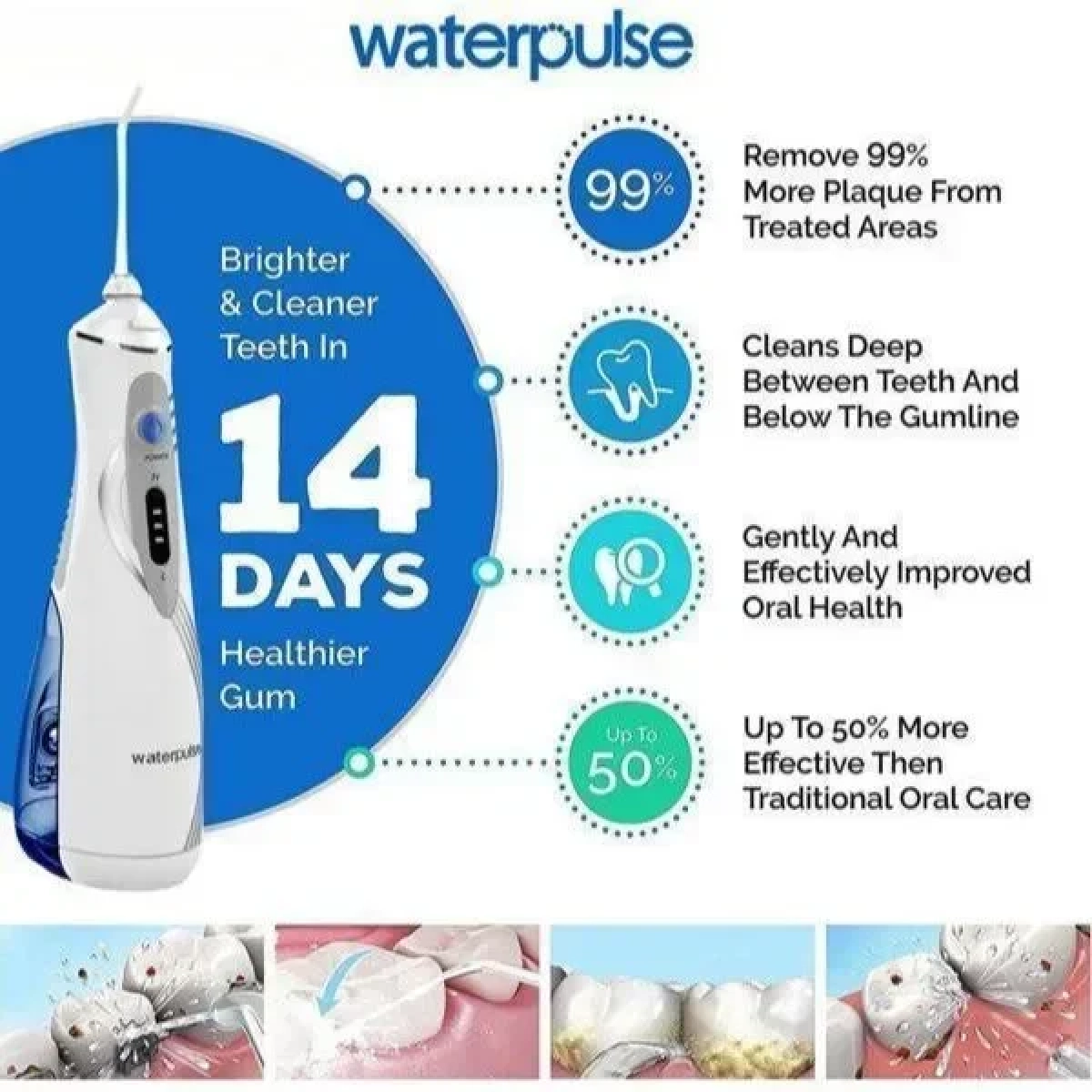 Ψεκαστήρας Νερού 240ml για Καθαρισμό Δοντιών Waterpulse V400 Plus - Λευκό