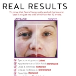 Derma Young Pro Skincare Derma beauty instrument CB0303 - Image 4