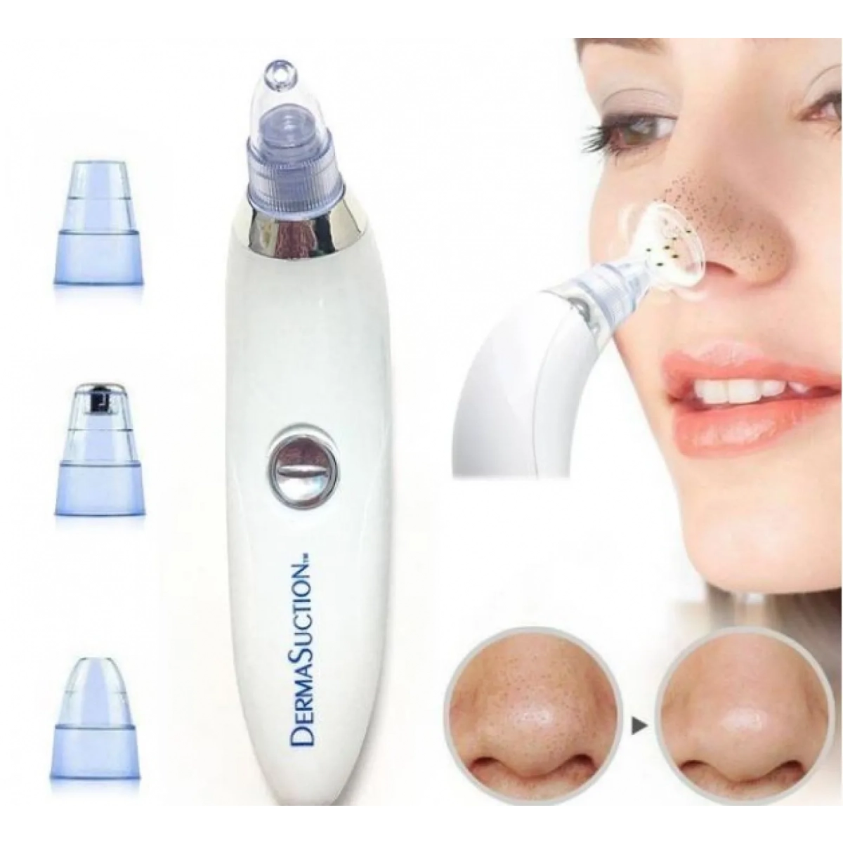 DermaSuction Συσκευή Καθαρισμού Προσώπου & Σμήγματος - Image 3