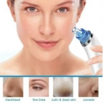DermaSuction Συσκευή Καθαρισμού Προσώπου & Σμήγματος - Image 6