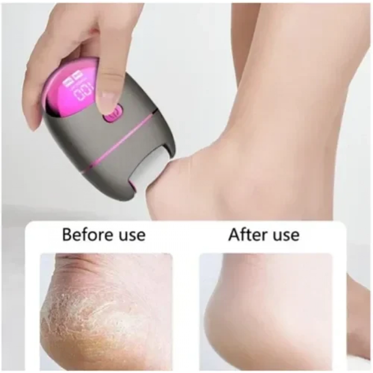 Ηλεκτρική λίμα ποδιών αφαίρεσης κάλων Electric Callus Remover ZM-718 λευκό - Image 2