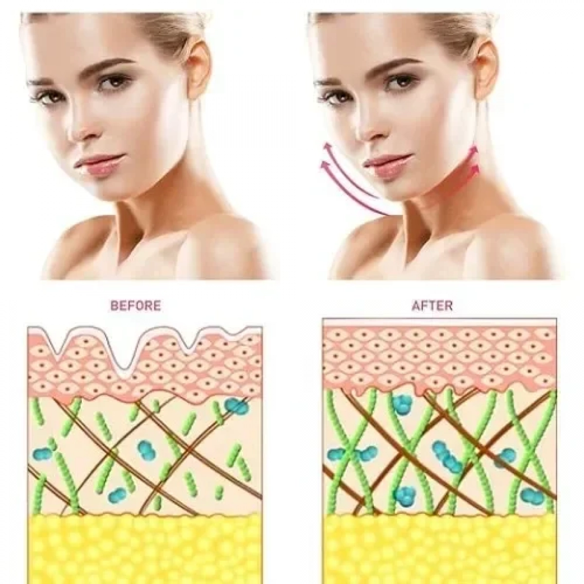 Mini Facial Toning Device Συσκευή Περιποίησης Προσώπου για Αντιγήρανση