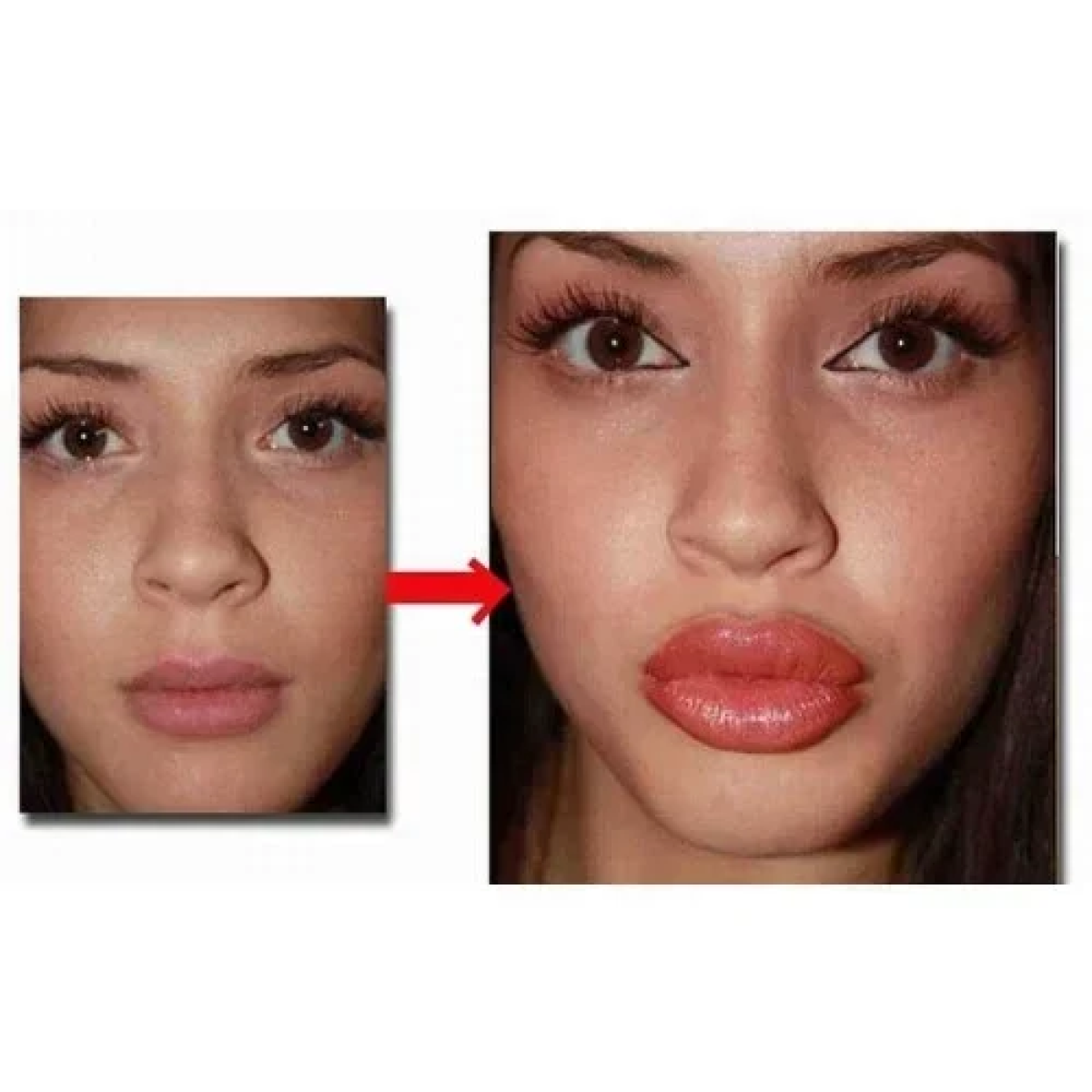 Lips Pump για Σαρκώδη και Αισθησιακά Χείλη