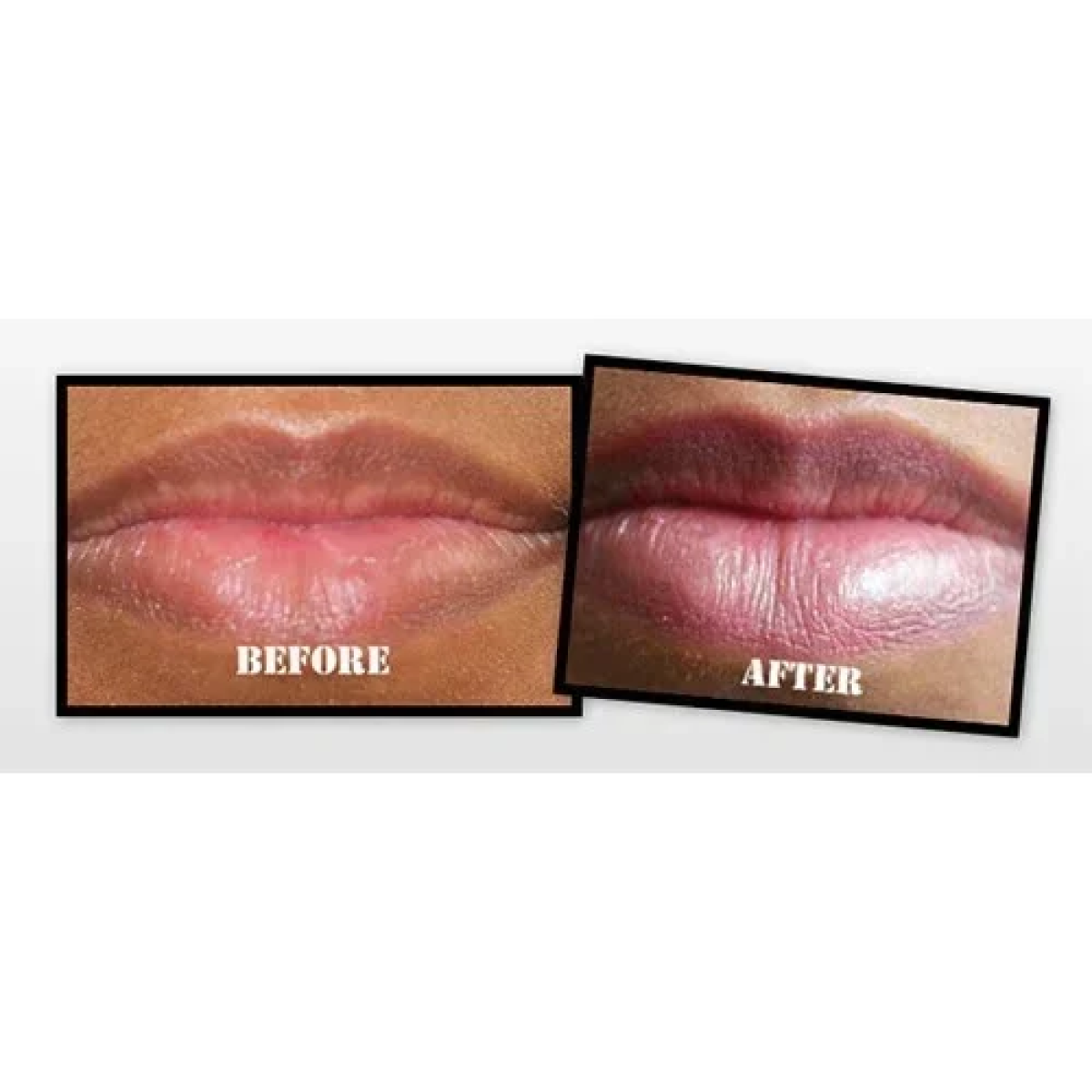 Lips Pump για Σαρκώδη και Αισθησιακά Χείλη