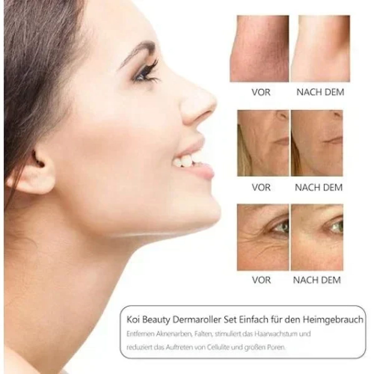 Σετ 6 σε 1 Derma Roller με βελόνες τιτανίου για Αντιγήρανση 0.5-2mm