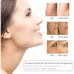 Σετ 6 σε 1 Derma Roller με βελόνες τιτανίου για Αντιγήρανση 0.5-2mm